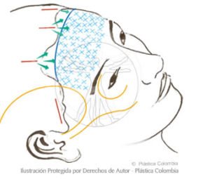 Colombia forehead stretch