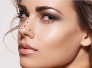 rhinoplasty