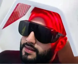 Laser alopecia Colombia