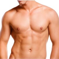 Gynecomastia colombia